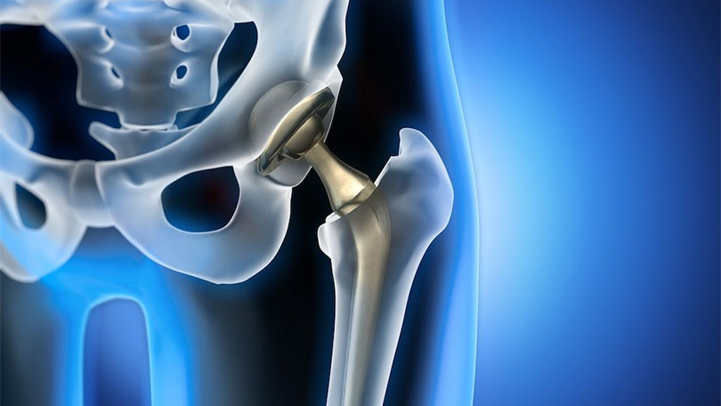 Chirurgie orthopédique et Traumatologique